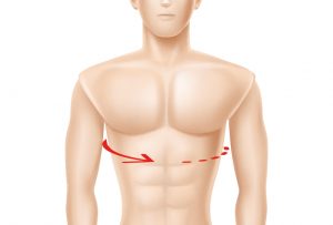 Corset toracic cardio ORTHOLAND ML-0208