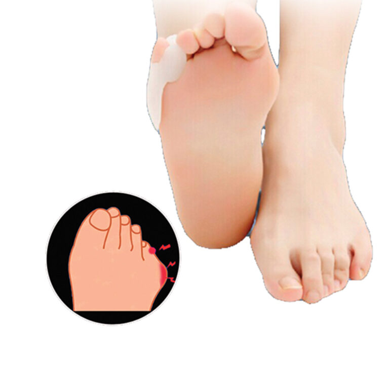 PERNITA DESP.CU PROT.BATATURI VITALMED (deget mic)