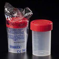 RECIPIENT UROCULTURA 60ML